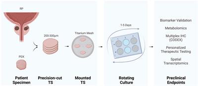 Harnessing the Utility of Ex Vivo Patient Prostate Tissue Slice Cultures